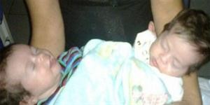 Piden ayuda para Bianca y Luciana, las siamesas internadas en el hospital Posadas | Actualidad