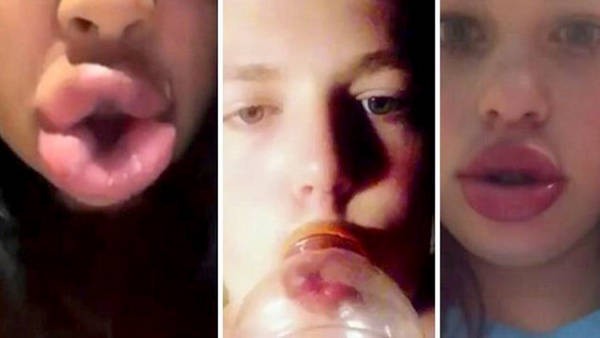 Nueva moda adolescente: deformarse los labios con un vaso | Actualidad