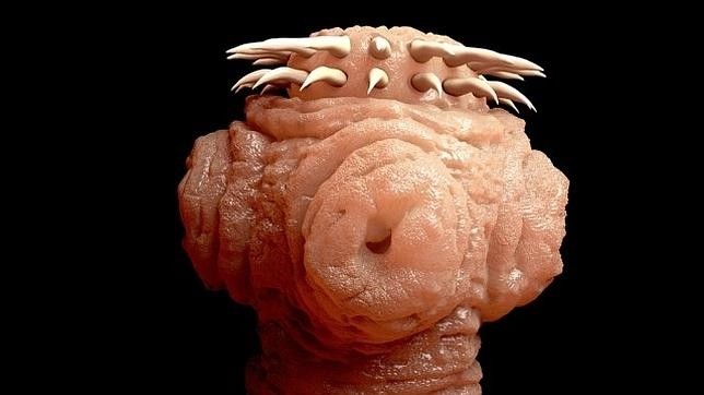 La historia de la mujer que vivió dos años con un parásito en la cabeza | Curiosidades