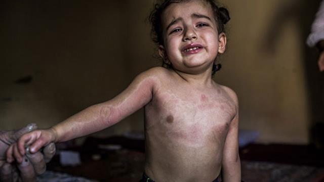 El relato devastador de una familia atacada con armas químicas por el Estado Islámico | Internacionales