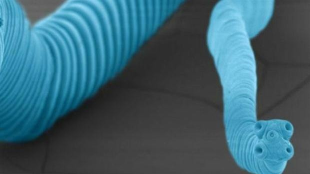 La historia del caso del colombiano que murió de un cáncer "no humano" | Curiosidades