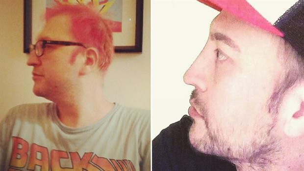 La nueva cara de Leo García:  lipoescultura facial y retoque en la nariz | Espectáculos