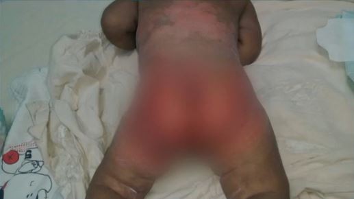 Padres que torturaban a su bebé fueron detenidos | Internacionales