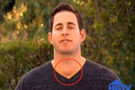 El conductor de tv que se salvó de un cáncer gracias a una televidente | Espectáculos