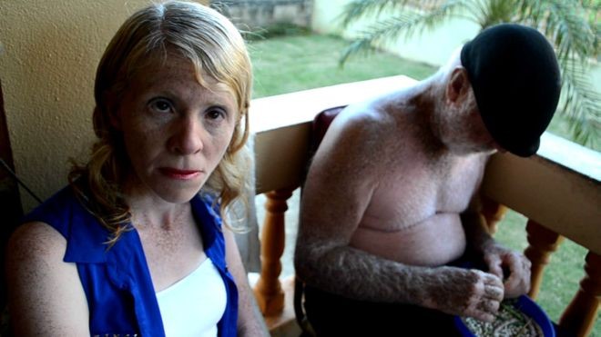 La conmovedora historia de la familia de albinos que vive encerrada en Puerto Rico | Internacionales