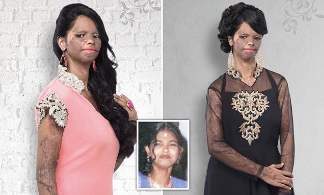 La desfiguraron con ácido y ahora es modelo de una marca de ropa | Curiosidades