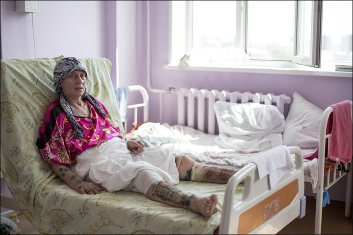 La mujer que fue atacada y enterrada por oso y vivió para contarlo | Internacionales