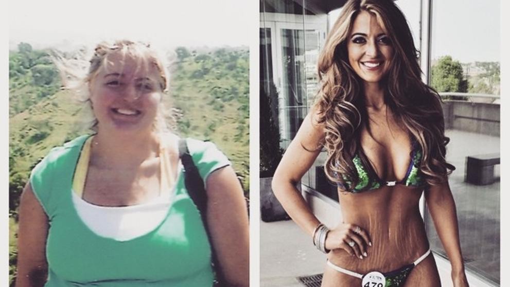 Perdió 60 kilos y ahora muestra con orgullo sus estrías | Curiosidades
