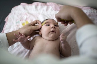 Brasil: más de 5.900 posibles casos de microcefalia relacionados con el zika | Internacionales