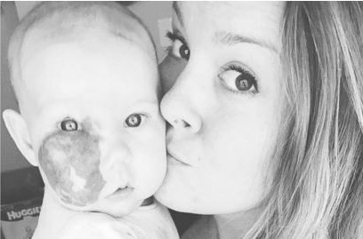 La madre que se cansó de la discriminación a su beba por una marca en su cara | Redes