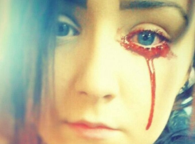 El misterio de la joven que sangra por los ojos | Curiosidades