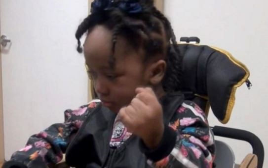 Una nena de 4 años sufrió daño cerebral por error de una dentista | Internacionales