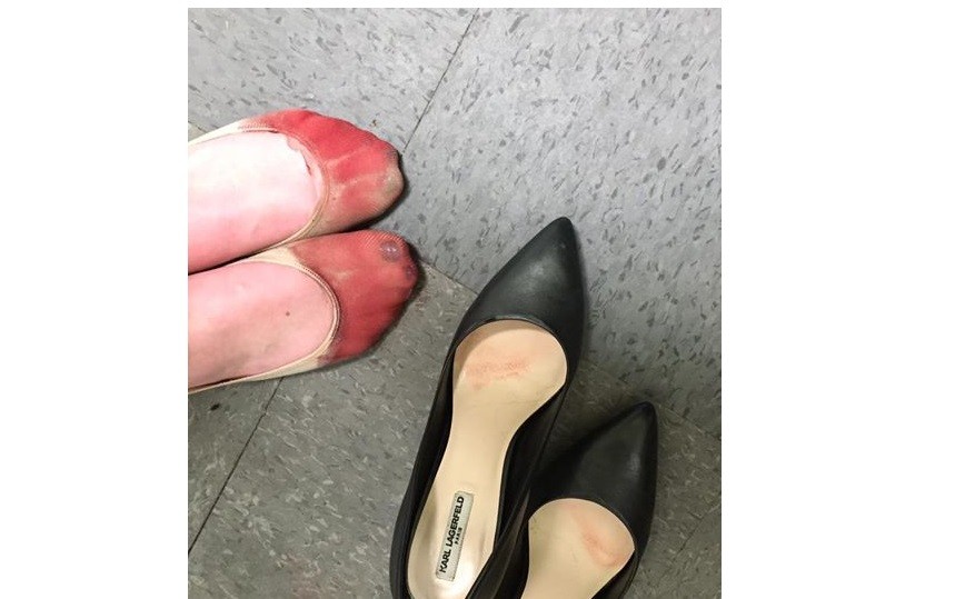 Denunció por Facebook que una empresa obliga a usar tacones aunque destrocen los pies | Redes