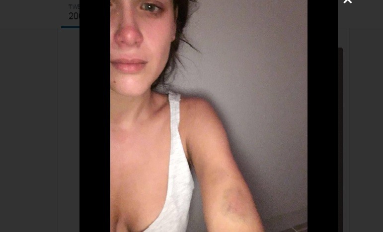 Nazarena Vélez difundió una foto de Barbie con moretones | Espectáculos