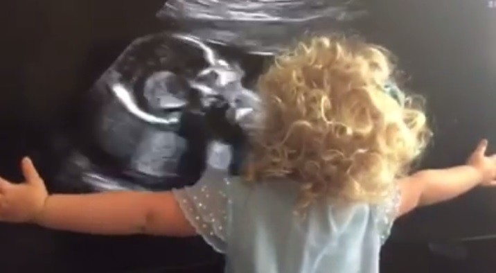 #EsViral La niña que rompe en llanto al ver la ecografía de su hermanita | Redes
