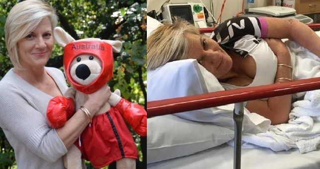 Australia: paseaba en bicicleta, se le tiró un canguro y le rompió las siliconas | Internacionales