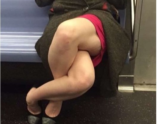 #FotoViral : ¿cómo hace esta mujer para cruzar las piernas así? | Redes