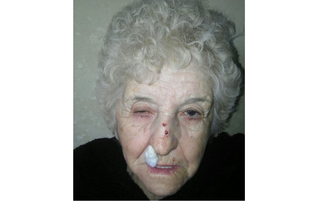 Al denunciar un robo, en la comisaría le pidieron un examen ginecológico y anal | Actualidad