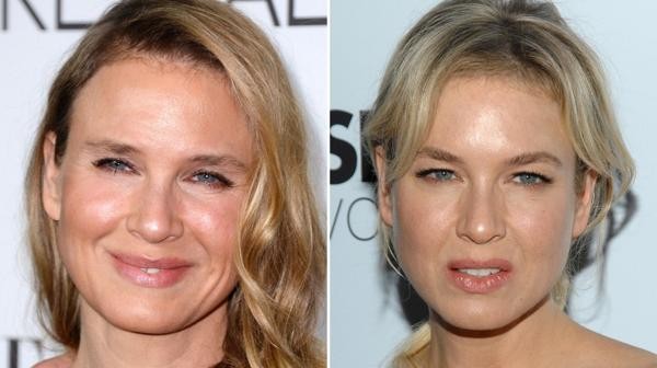 Duro descargo de Renee Zellweger: apuntó a quienes la critican por sus cirugías | Espectáculos