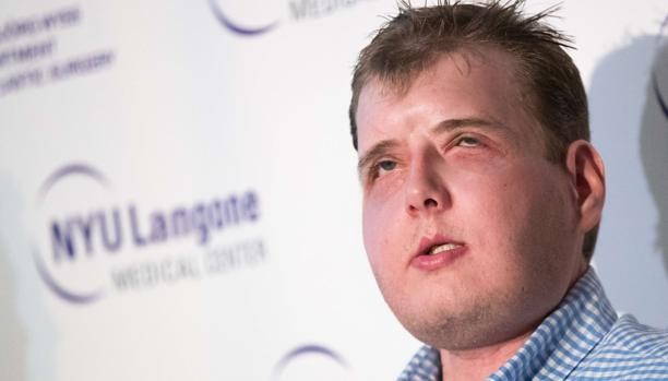 La nueva vida del bombero de Estados Unidos que se sometió a un trasplante de cara | Curiosidades