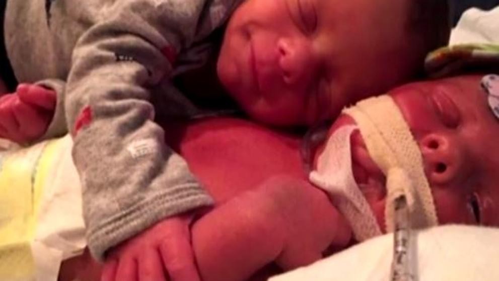 La historia que esconde esta foto del tierno abrazo de dos gemelos recién nacidos | Curiosidades