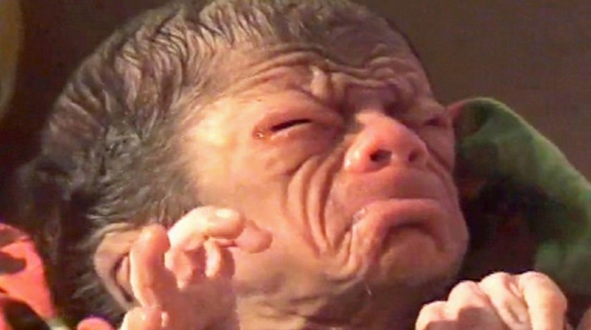 El extraño caso del bebé "Benjamin Button": nació con arrugas y cubierto de pelos | Curiosidades