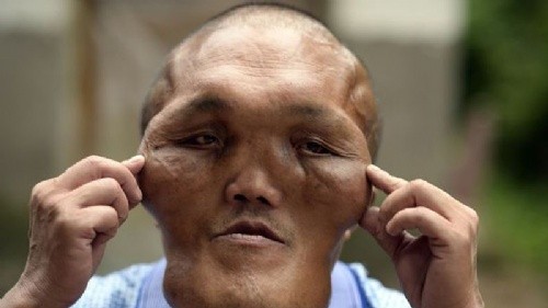 El hombre con "cara de alien" que conmociona a China | Curiosidades