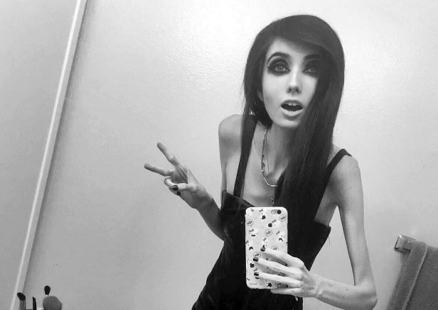 Piden el cierre del canal de Youtube de una joven que pesa 27 kilos porque puede inducir a la anorexia | Redes