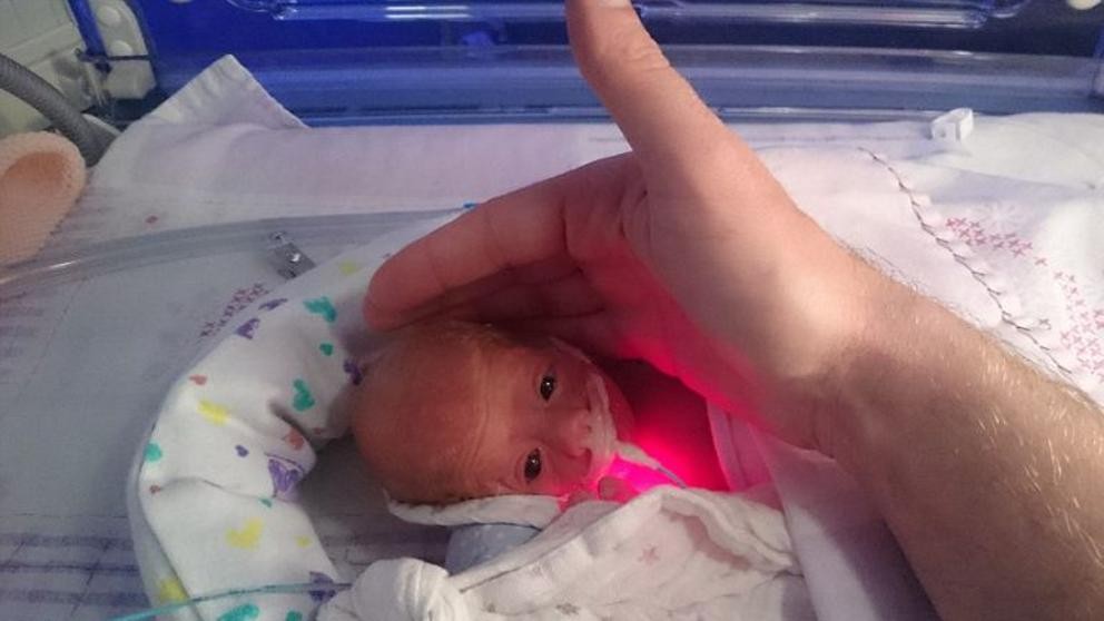 Milagro: la historia del bebé prematuro que salvó su vida gracias a una bolsa de galletitas | Curiosidades