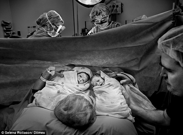 Una mujer quedó embarazada dos veces en 10 días | Internacionales