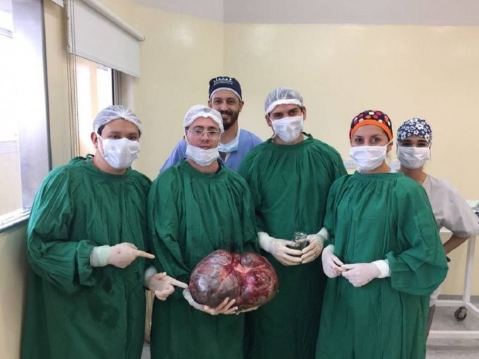 Catamarca: extirparon un tumor de 15 kilos a una mujer | Actualidad
