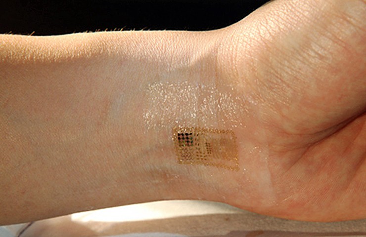 Una empresa belga implanta un "chip" de identificación bajo la piel sus empleados | Tecno