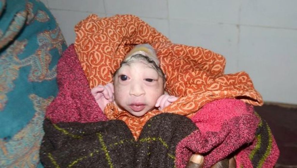 India: una mujer se niega a darle el pecho a su bebé por una malformación | Curiosidades