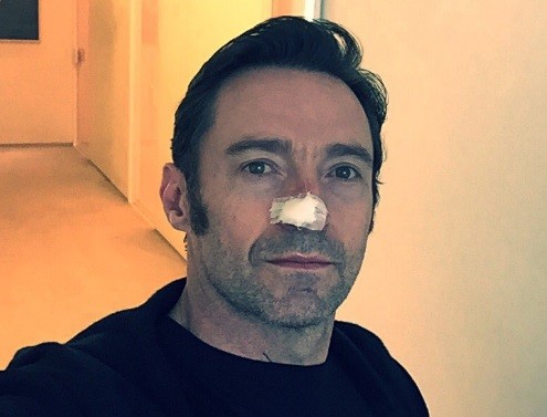 El actor Hugh Jackman se sometió a otro tratamiento contra el cáncer de piel | Espectáculos