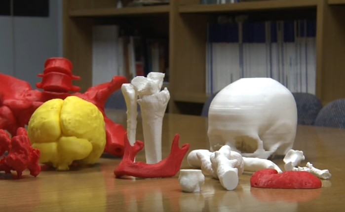 En la Favaloro operaron por primera vez con un órgano impreso en 3D como referencia | Tecno