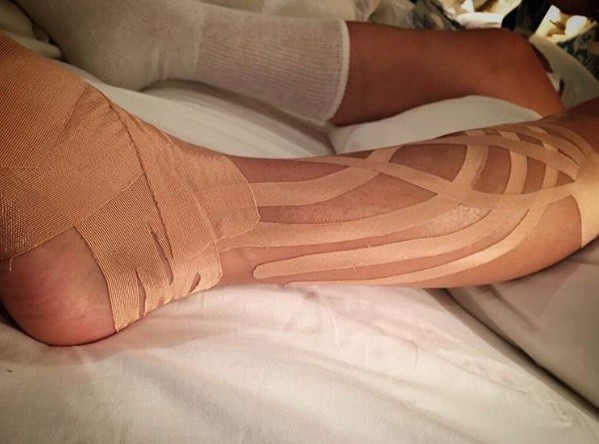 Así quedó la pierna de Paulina Rubio luego de su caída al vacío en pleno concierto | Espectáculos