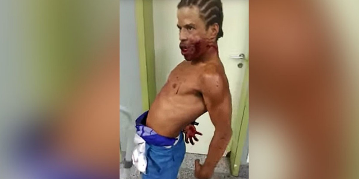 Un hombre “poseído” generó terror en un hospital de Brasil | Redes