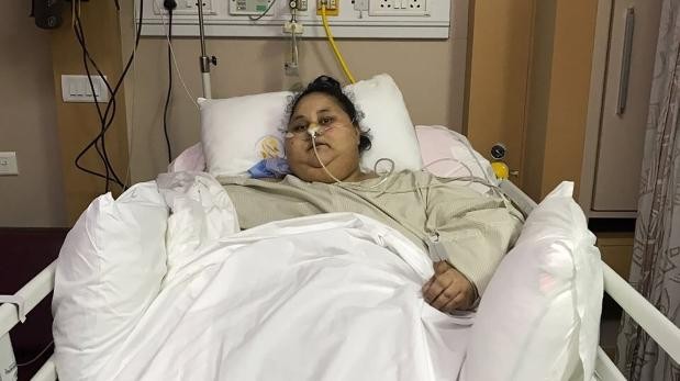 La mujer más obesa del mundo que perdió 100 kilos en la India | Internacionales