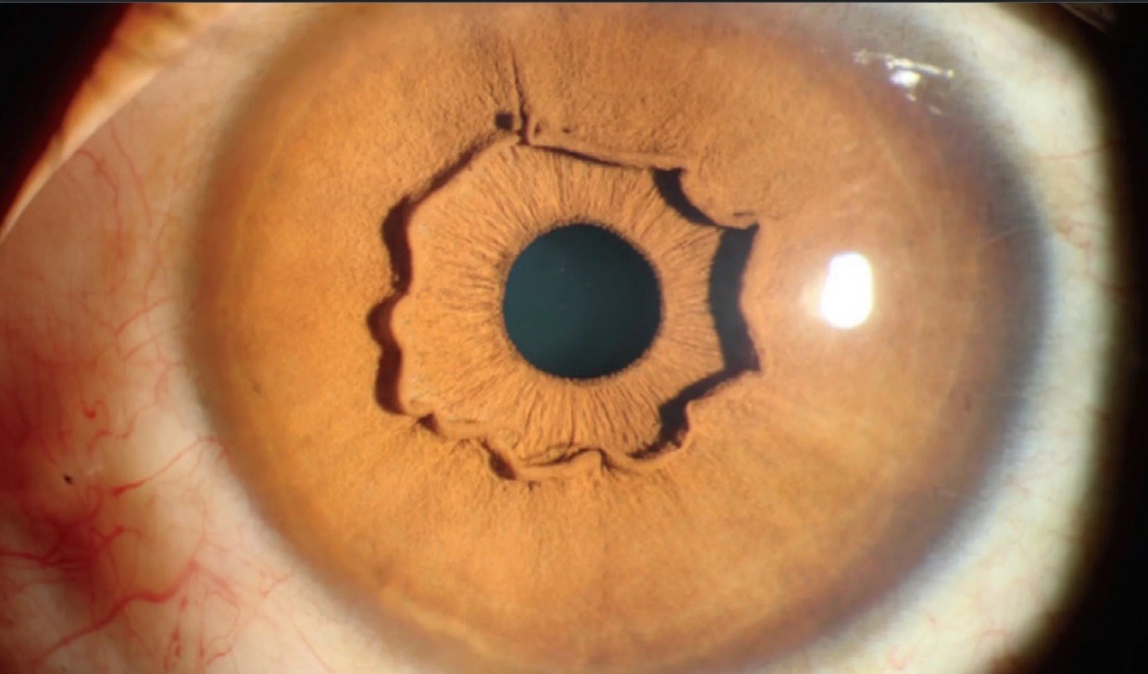 Los ojos de una mujer en China sorprenden a los especialistas | Internacionales