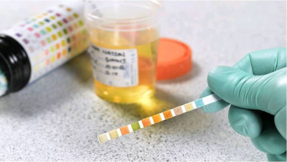 La historia del hombre que se alimenta de su propia orina | Curiosidades