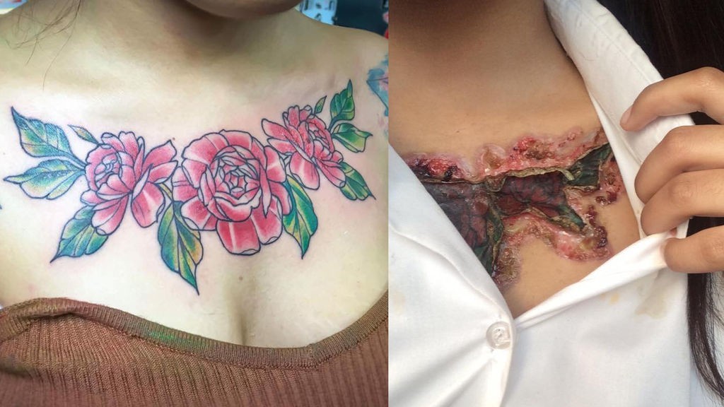 El calvario de una chica que intentó borrar en forma casera en tatuaje que tenía en el pecho | Curiosidades