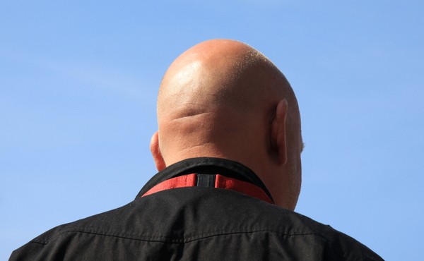 Alerta por el asesinato de personas con calvicie para sacarle los órganos en Mozambique | Internacionales