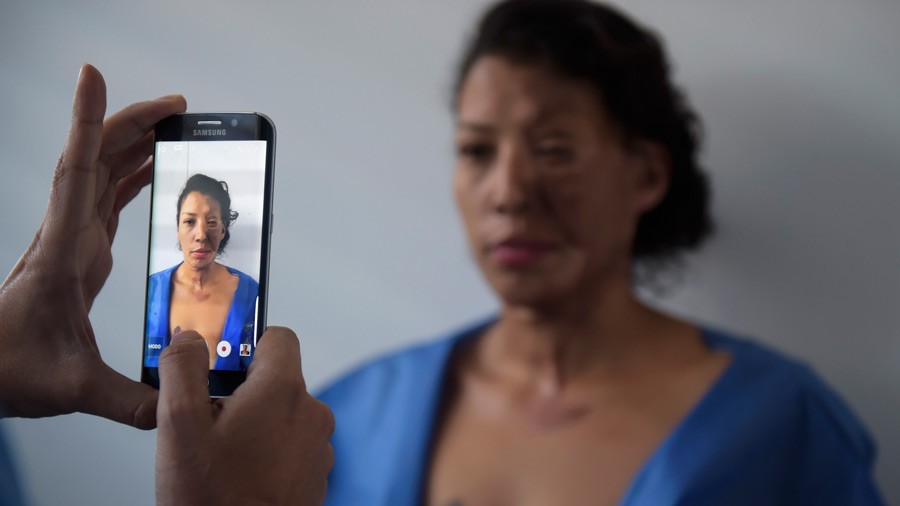 La historia del doctor colombiano que le devuelve la sonrisa a las mujeres que fueron víctimas de ataques con ácido | Internacionales