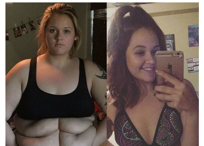 La historia de la joven que adelgazó 76 kilos y pudo usar bikini por primera vez | Curiosidades