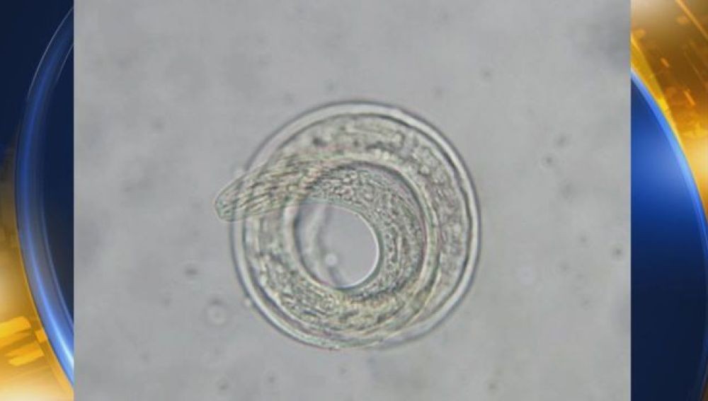 Alerta en Estados Unidos por un parásito letal que ataca el cerebro humano | Curiosidades