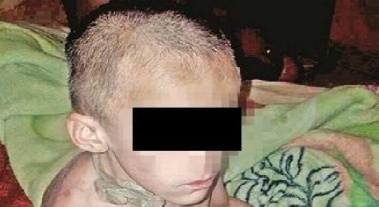 Conomoción en México: el terrible caso del nene que fue hallado encadenado, desnutrido y con signos de torturas | Internacionales