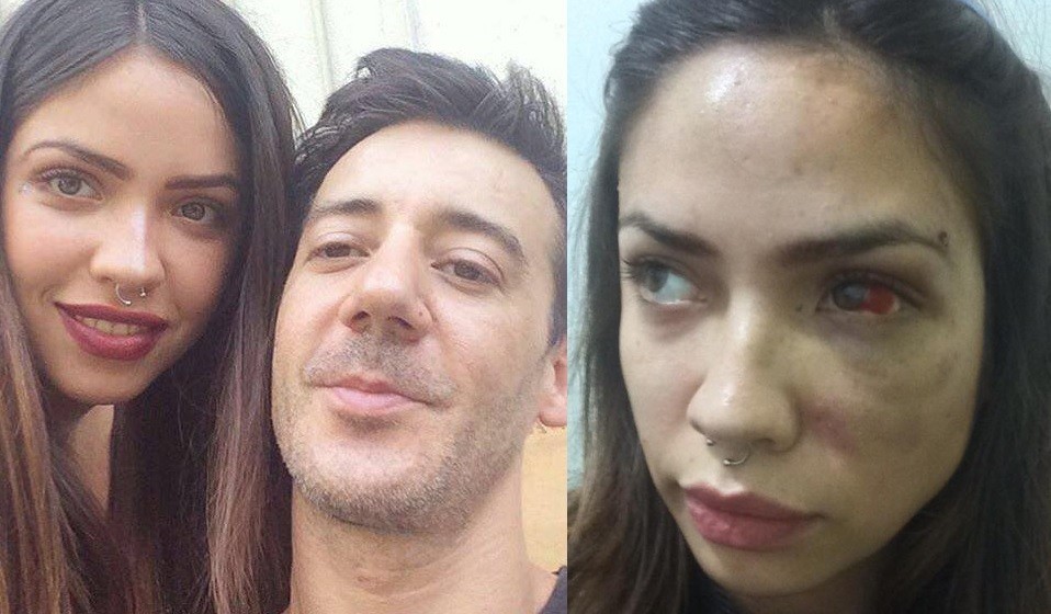 La banda Los Tetas echó al cantante luego de que su novia lo denunció por golpizas | Internacionales