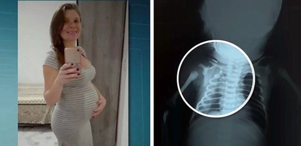 Este bebé fue baleado en el vientre de su mamá y logró sobrevivir | Internacionales