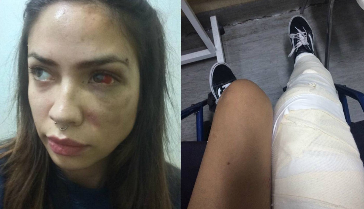 El estremecedor relato de una joven que vivió un calvario junto a un famoso cantante chileno | Internacionales