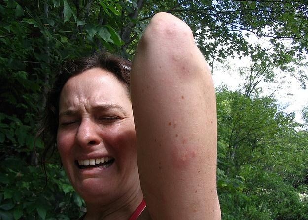 Las cinco razones por las cuales los mosquitos pican a unas personas y a otras no | Curiosidades